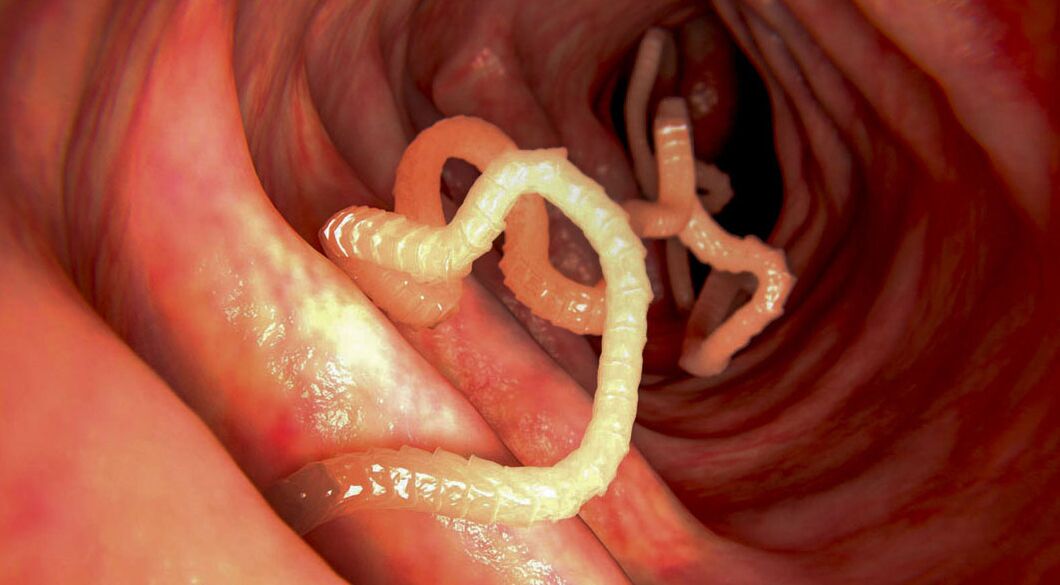 Diagnose von Parasiten im Darm