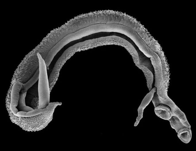 Schistosome aus dem menschlichen Körper