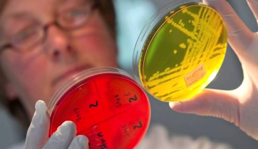 Diagnose von Parasiten im menschlichen Körper