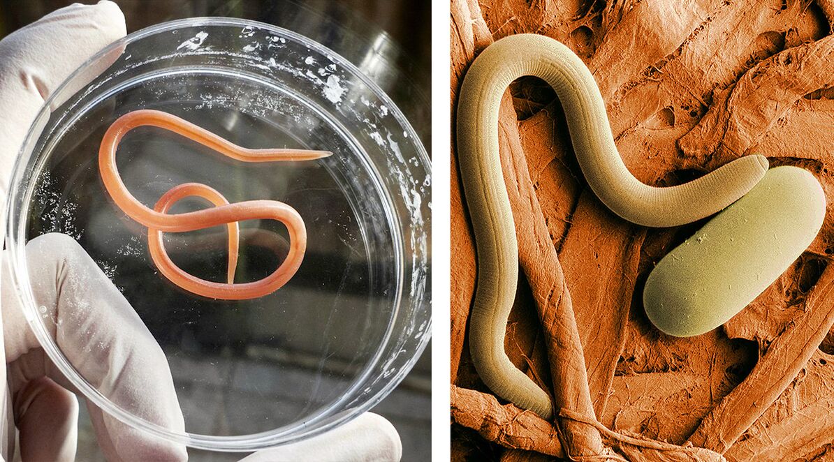 Parasiten im menschlichen Körper