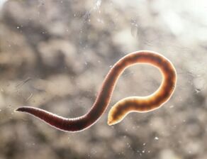 Wurmparasit des Menschen