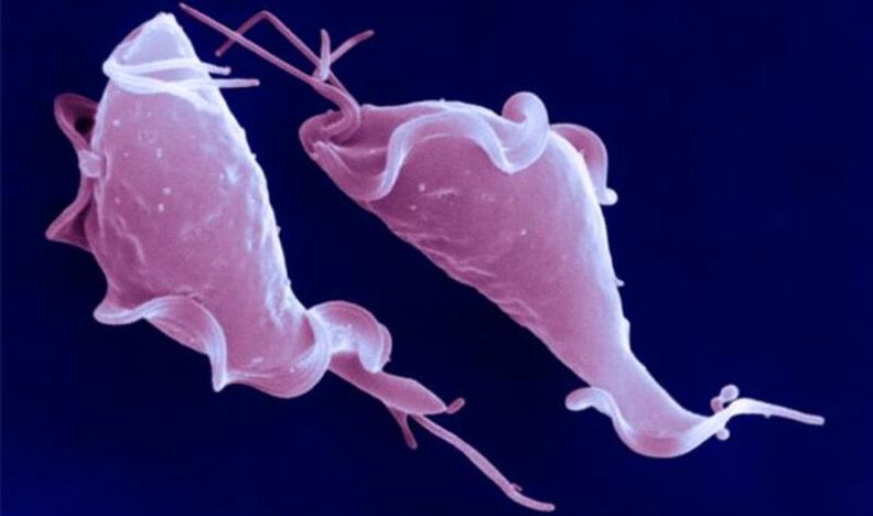 Trichomonas vaginalis ist ein einzelliger Parasit, der Unfruchtbarkeit verursacht.
